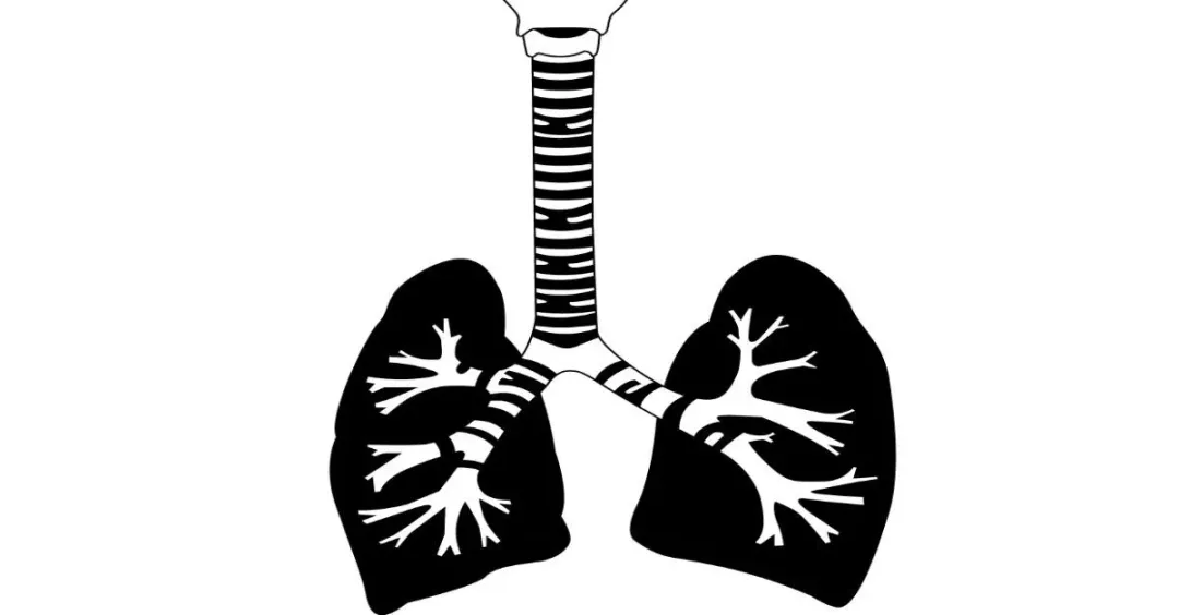 慢性阻塞性肺病的患者的痰液會不正常地大量分泌，支氣管擴張症的痰液則更多。（示意圖／123RF）