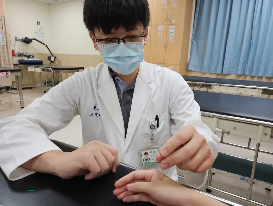 馬偕中醫師以合谷穴為病人進行針灸治療。(圖/馬偕兒童醫院提供)