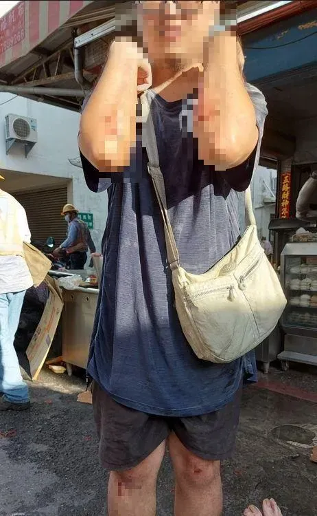 29歲男遭玻璃割手。(圖／翻攝畫面)