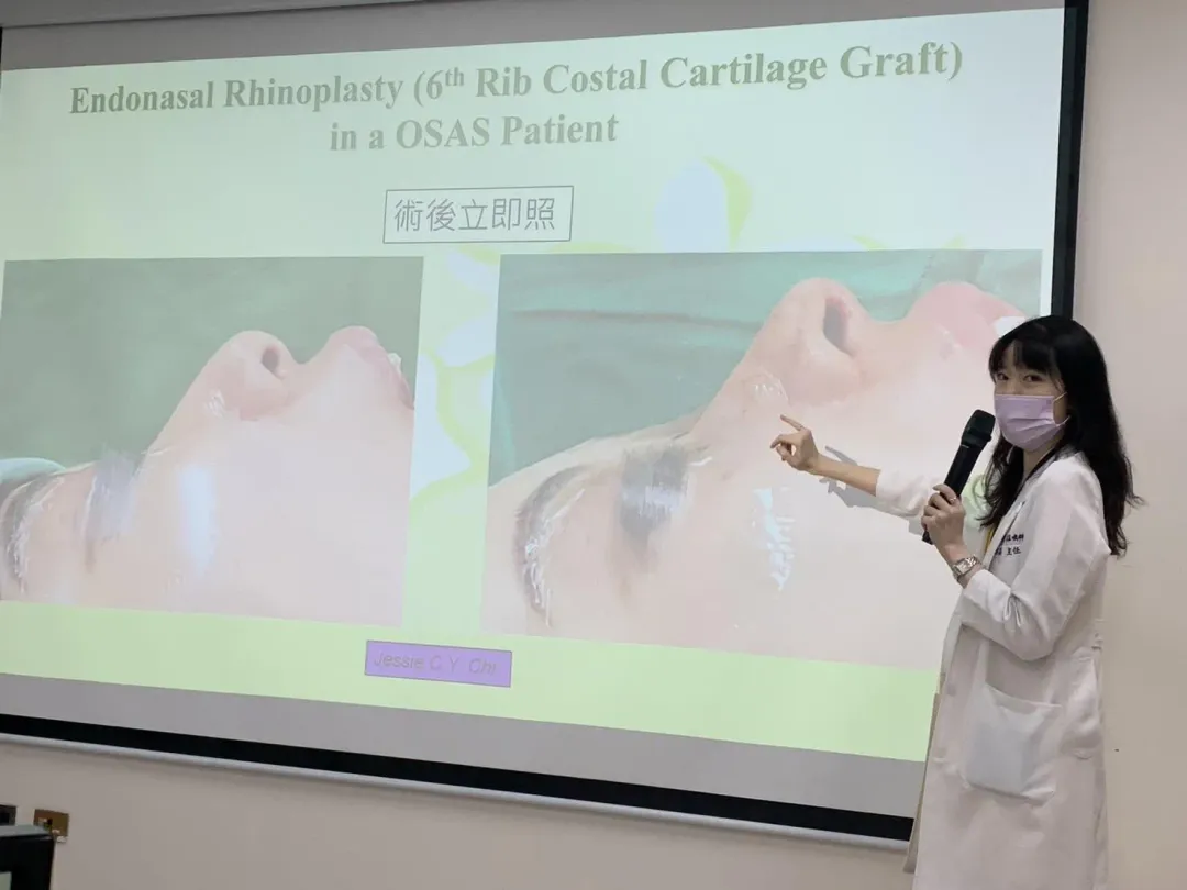 衛生福利部臺中醫院耳鼻喉科主任季照芸說明「功能性暨美觀性鼻整形手術」術後立即照。個案治療前(左)後(右)。(圖/台中醫院提供)