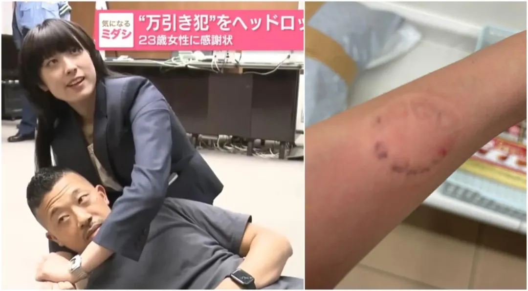 梁果琳還原如何制伏歹徒，逮人當天手腕也被咬出血痕。（圖／翻攝NNN、X）