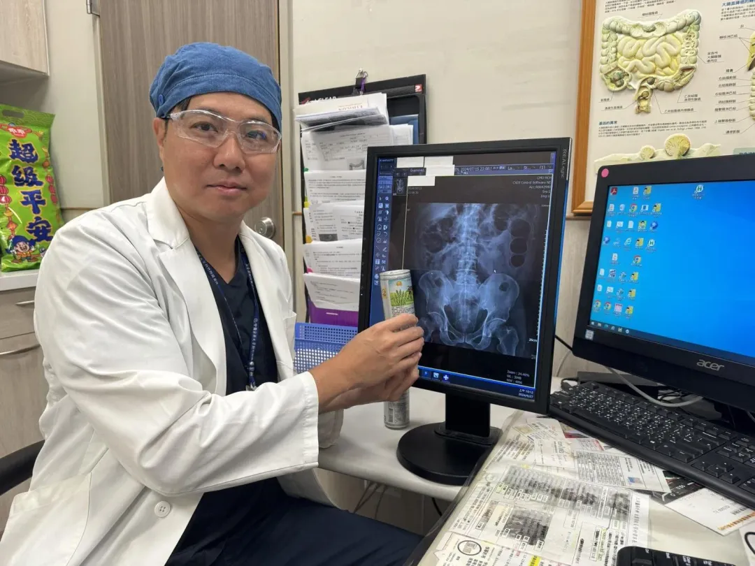 經2個多小時手術後終於將鋁罐取出。（圖／翻攝畫面）