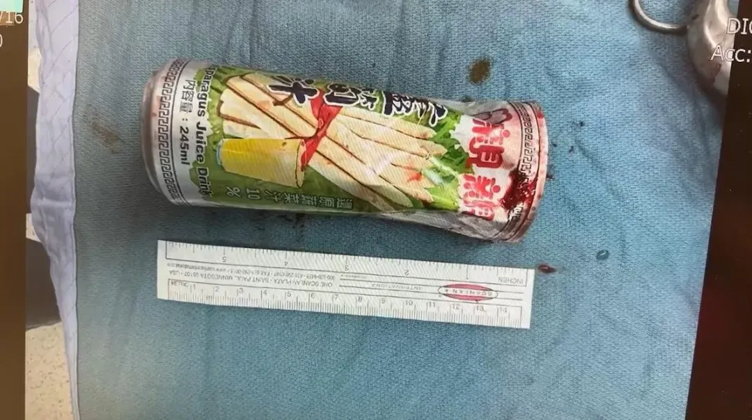 取出後的蘆筍罐沾滿血跡，瓶身變形。（圖／翻攝畫面）