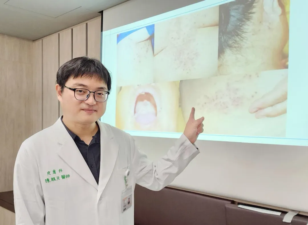 奇美醫療財團法人奇美醫院皮膚科主治醫師陳麒亘。（圖／奇美醫院提供）