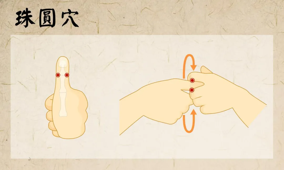 珠圓穴。(圖/北市聯醫提供)
