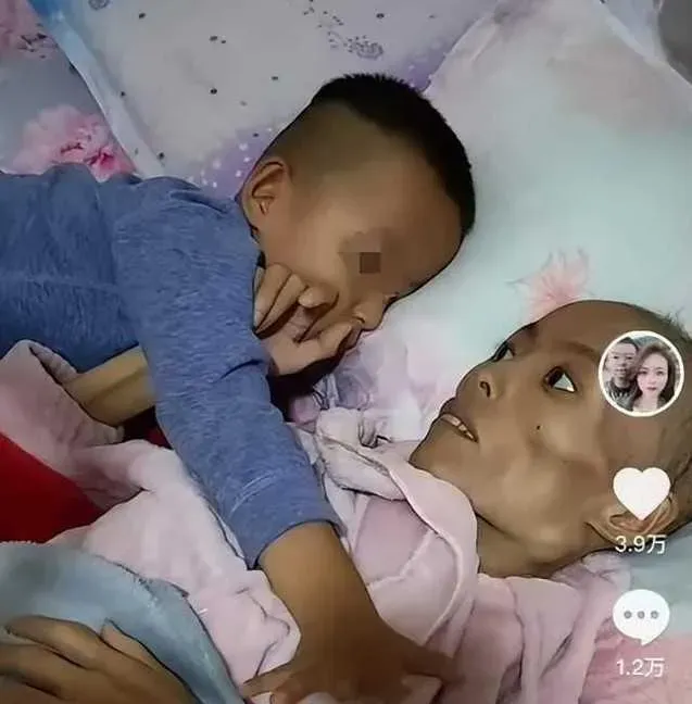 罹癌人妻離世前病容枯槁，但不會忘記用最後的力氣安撫孩子。（圖／翻攝自《極目新聞》）