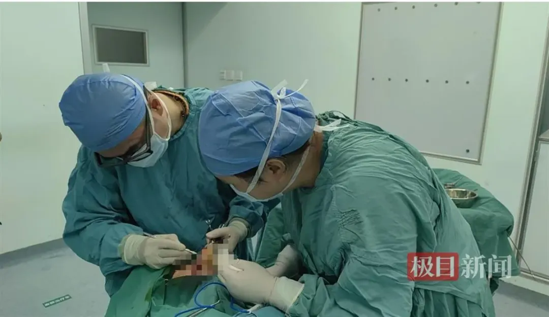 醫療團隊為老翁切除鼻部病灶，並重塑鼻部形態。（圖／翻攝極目新聞）