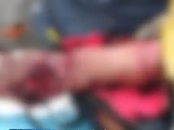 有村民散步遭撕咬左手血肉模糊。（圖／翻攝沸點）