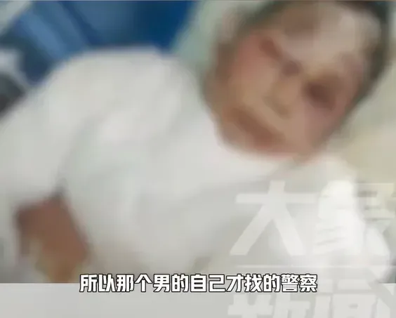 遭虐女子臉部到上半身嚴重燙傷，施暴男子的父親接到警方通知竟表示「不管、不賠」。（圖／翻攝自微博@大象新聞）