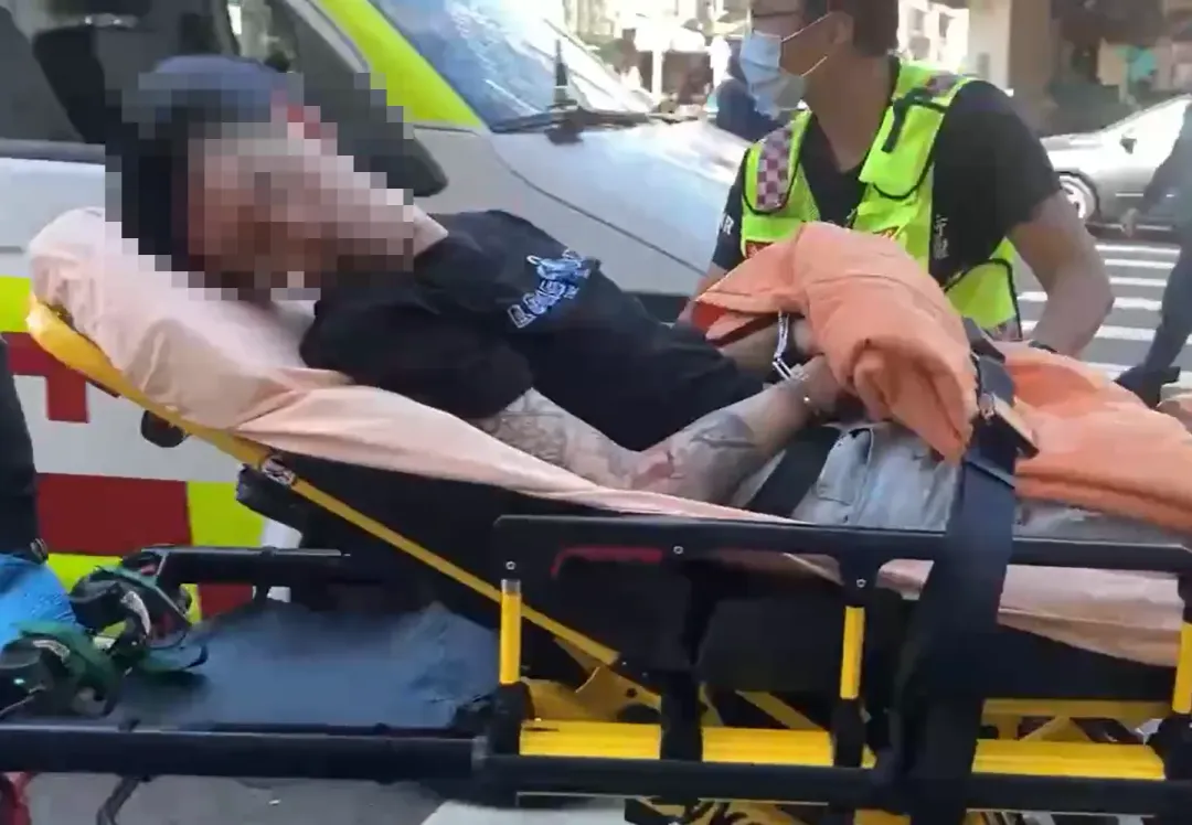 林男酒駕造成路人1死2傷，自己也有開放性骨折，被捕時還躺在擔架上呼呼大睡。（圖／中天新聞）