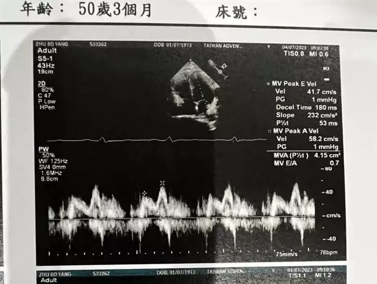 Paul的醫生指出該處腫瘤進行手術會有危險，目前都以吃藥和調整生活習慣穩定病況。（圖／翻攝自Facebook@Paul與咪咪的朱式會社）