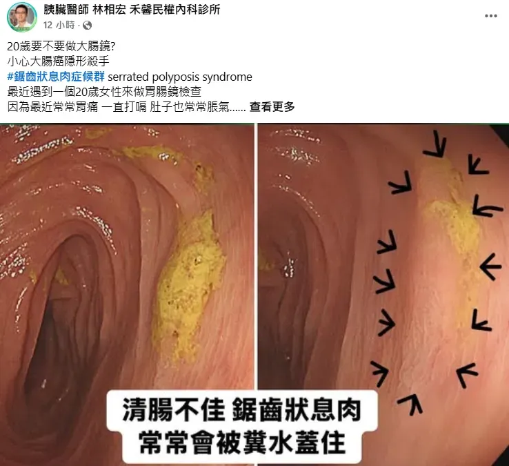 (圖/翻攝自胰臟醫師 林相宏 禾馨民權內科診所)