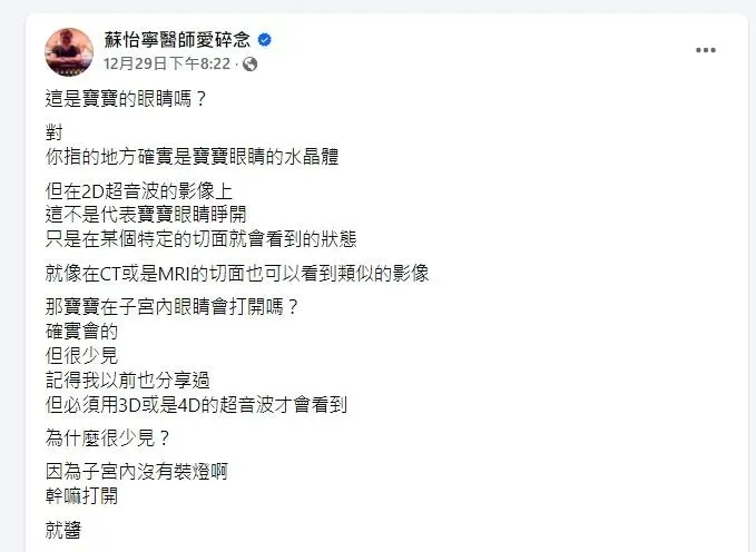 一名網友在看寶寶超音波影像時，驚訝發現腹中寶寶疑似「睜大眼睛」，忍不住求問醫生「寶寶眼睛怎麼瞪這麼大？」（圖／翻攝自臉書 蘇怡寧醫師愛碎念）