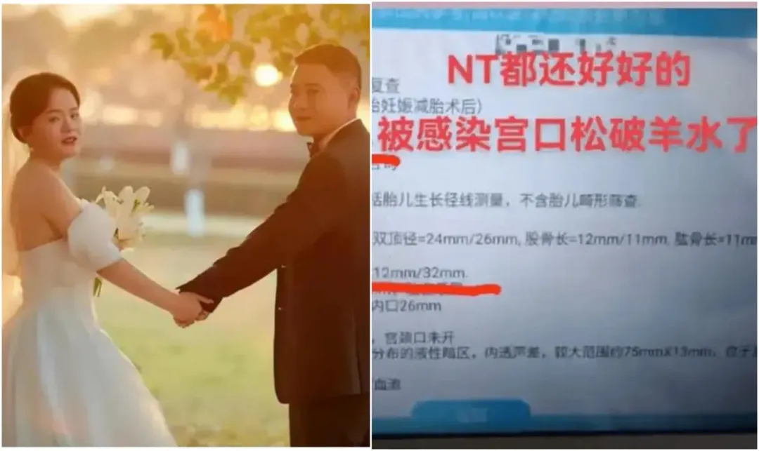 南昌九胞胎孕婦,最後兩胎沒保住。(圖/翻攝微博)