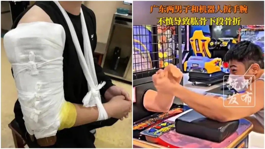 佛山2名年輕男性因為挑戰腕力機而骨折送醫。（圖／翻攝微博）