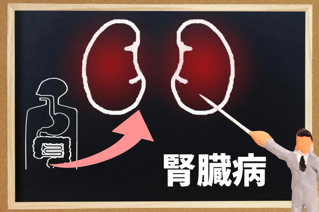 腎臟病示意圖。(圖/PhotoAC)