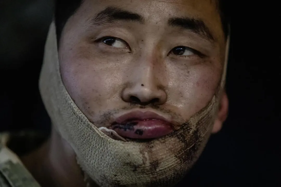 李姓士兵被俘時，下巴遭子彈打中受傷。（圖/美聯社）