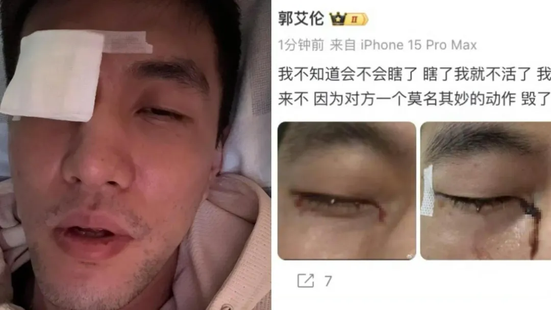 郭艾倫PO出流血照控訴隊友害他結膜破碎縫了40多針。（圖／翻攝微博）