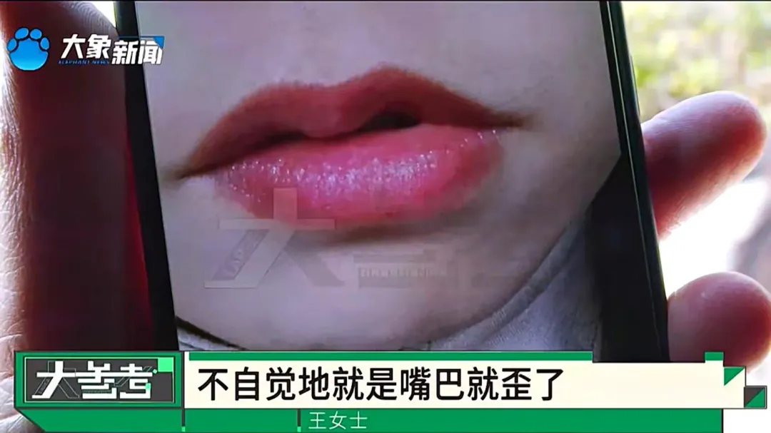 人妻怒控做完陰道整形手術後嘴巴歪了。（圖／翻攝大參考）