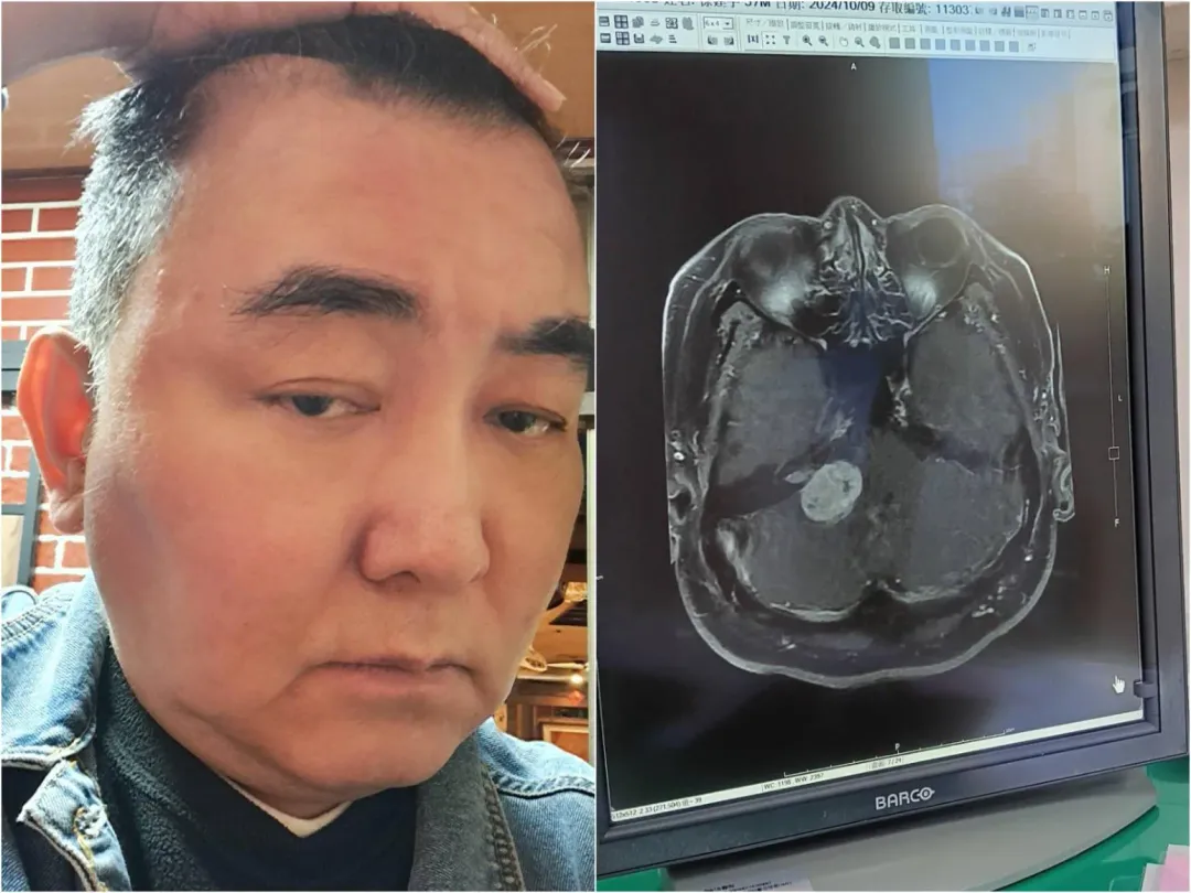 徐亨透露自己的健康狀況。(圖/翻攝自臉書徐亨-鐵粉團隊-鐵亨團)