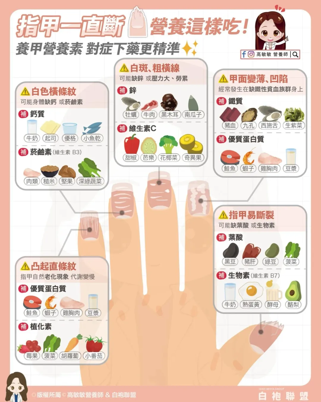 針對不同的指甲症狀，代表身體某處可能出現問題。（圖／高敏敏 營養師）