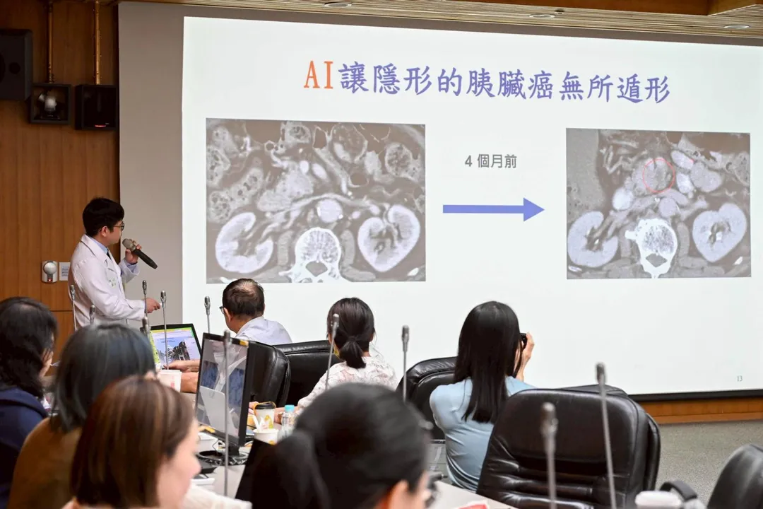 要在CT影像中找到腫瘤小於2公分的早期胰臟癌，陳柏廷以「海底撈針」形容，導致過去約有40%病灶易被忽略。（圖／台大醫院）