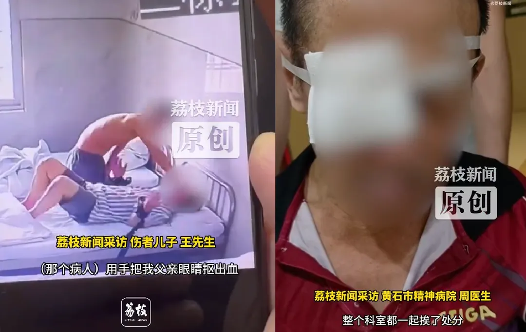 王男父親在住院期間，眼球遭精神病友用手挖出。（圖／翻攝微博@荔枝新聞）