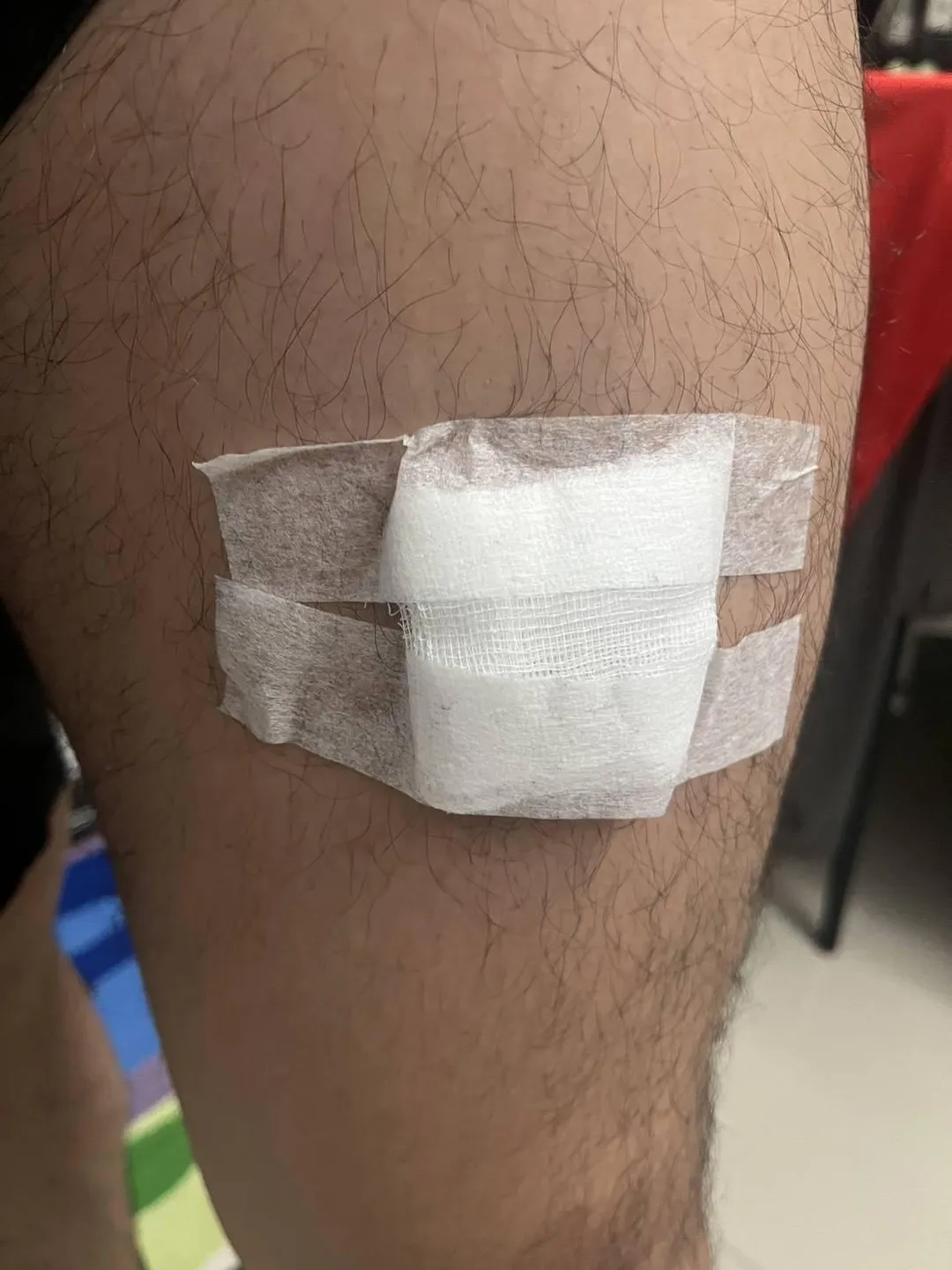 員警至醫院包紮傷口照片（左膝蓋上方被咬傷）。（圖／翻攝畫面）