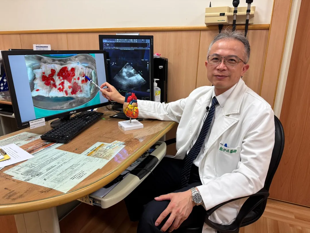 鄭伊佐醫師說明,心臟黏液瘤為良性腫瘤,像果凍般在心臟內擺動會引發血栓,以中風症狀做表現,只要妥善治療預後都能良好。(圖/台中慈濟醫院)