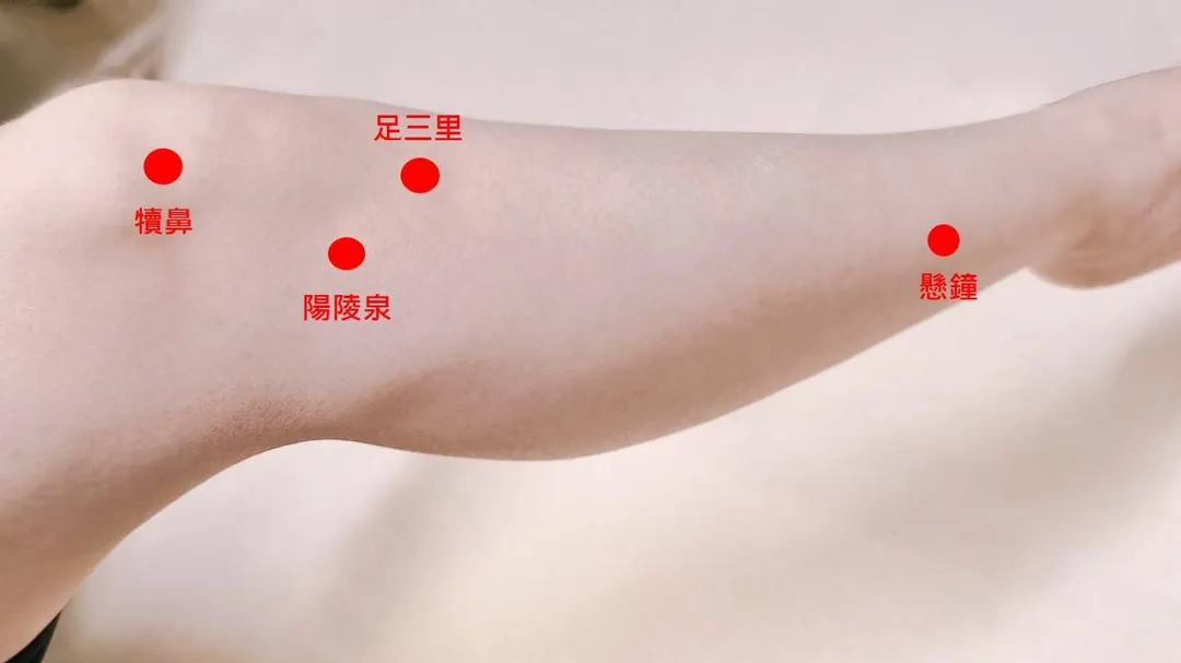 中醫透過針灸治療,能促進膝部與腿部的血液循環,以達到止痛、消腫效果。常用穴位包含犢鼻、足三里、陽陵泉、懸鐘與血海等。(圖/台南市立醫院)