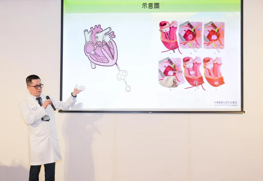 林有騫主任說明，這次中醫大附醫採用NeoChord技術，在心臟持續跳動下，藉由3D經食道心臟超音波導航，精準植入人工鍵索，修補二尖瓣脫垂處。（圖／院方提供）