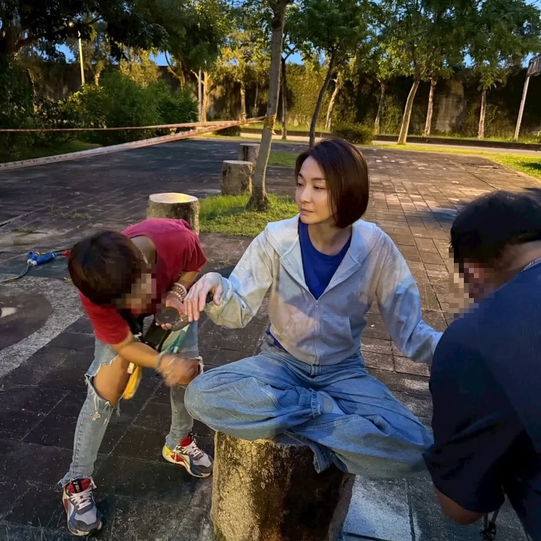 知名八點檔女演員江祖平近日在社群平台Threads上發文控訴，在拍攝現場遭遇嚴重的職業傷害，不僅被滾燙的熱湯潑濺到手部及身上，更被要求忍痛繼續演出。（圖／翻攝自江祖平IG）