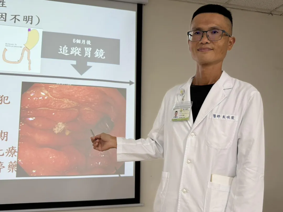吳明駿醫師幫患者檢查胃鏡，發現剩下的胃又出現癌細胞，稱之「殘胃癌」。（圖／台中醫院）