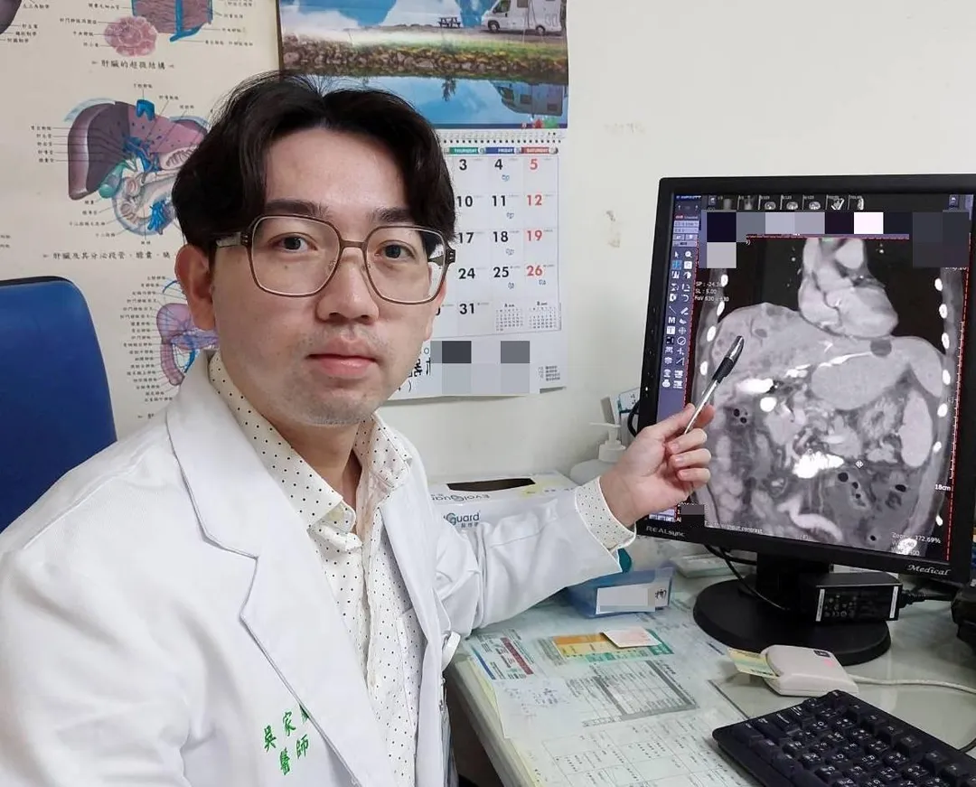 吳家慶醫師表示，因病人膽汁無法排出，故以引流術將滯留膽汁排出，降低黃疸指數。（圖／大千醫院）