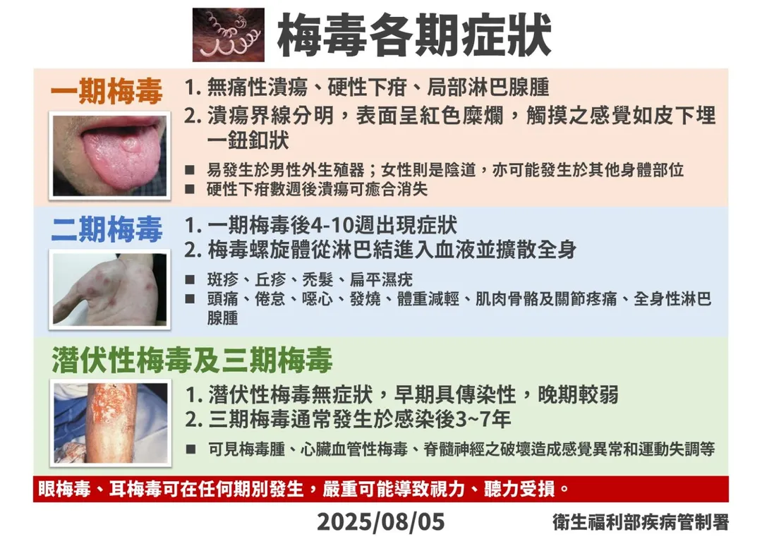 梅毒感染初期常見無痛性潰瘍與硬性下疳，具高傳染性。（圖／疾管署）