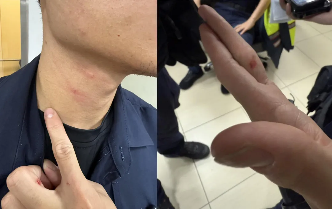 員警傷勢照。（圖／翻攝畫面）