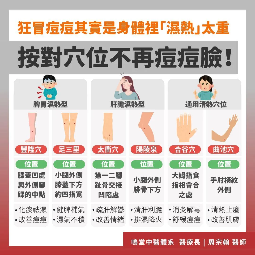 針對不同類型的濕熱痘痘，周宗翰建議可透過特定穴位按摩來改善。（圖／翻攝自周宗翰醫師臉書）