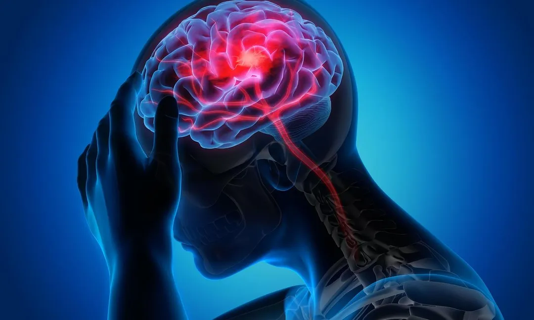 許多人都有頭痛問題，醫師提醒，若不積極治療，變成慢性疼痛將更難根治。（示意圖／Pixabay）