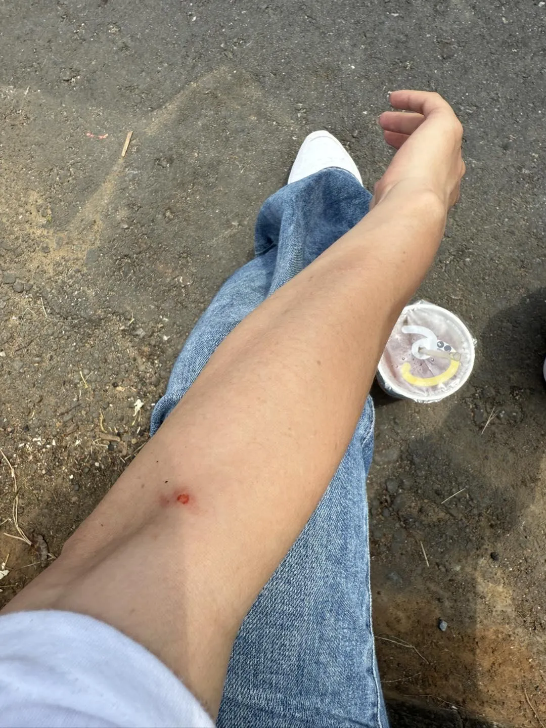 陳智菡在民眾黨舉辦的「走讀」活動中，因與警方衝突而受傷。（圖／翻攝陳智菡臉書）