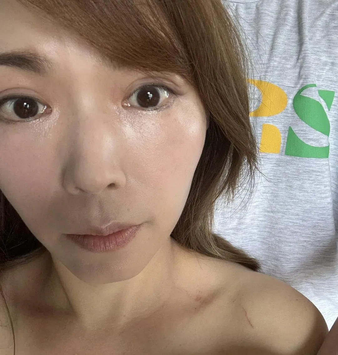 陳智菡表示,自己在30日的衝突中遭抓傷,項鍊也被扯斷。(圖/翻攝陳智菡臉書)