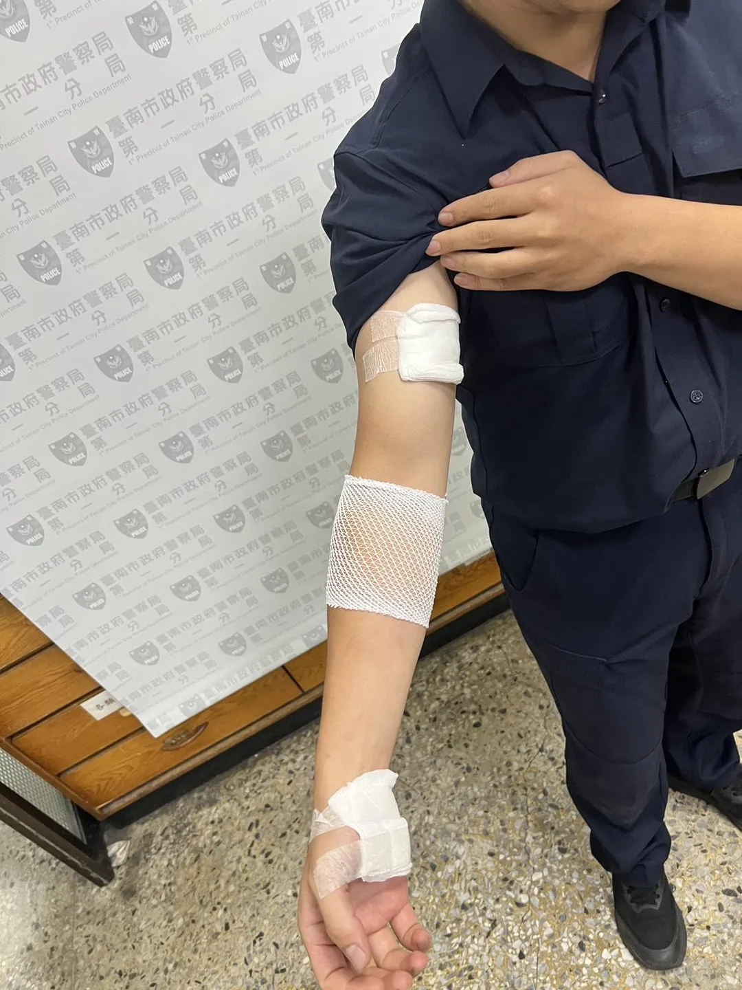 台南一分局德高派出所所長林海平於圍捕嫌犯時，遭對方咬傷手臂。（圖/警方提供）