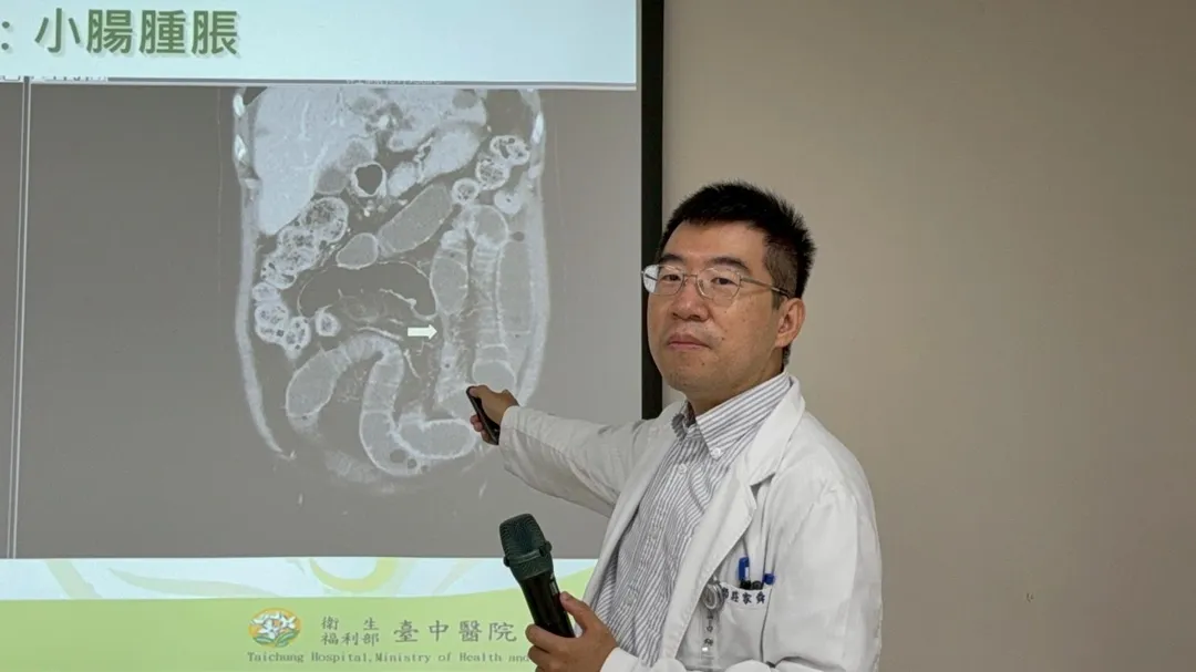 台中醫院肝膽腸胃科莊家舜醫師說明少年小腸腫脹的狀況。（圖／臺中醫院）