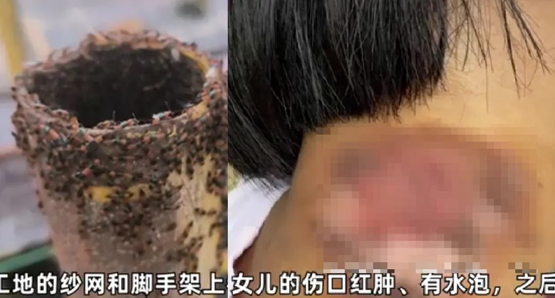 河南多地出現大量隱翅蟲群聚,有女童因誤沾隱翅蟲毒液導致嚴重皮炎。(圖/翻攝《眾播視頻》)