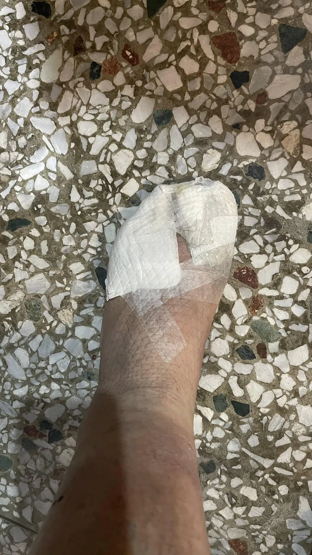 花蓮光復鄉大安村長徐振雄救災期間腳受重傷。。(圖/翻攝自徐振雄臉書)