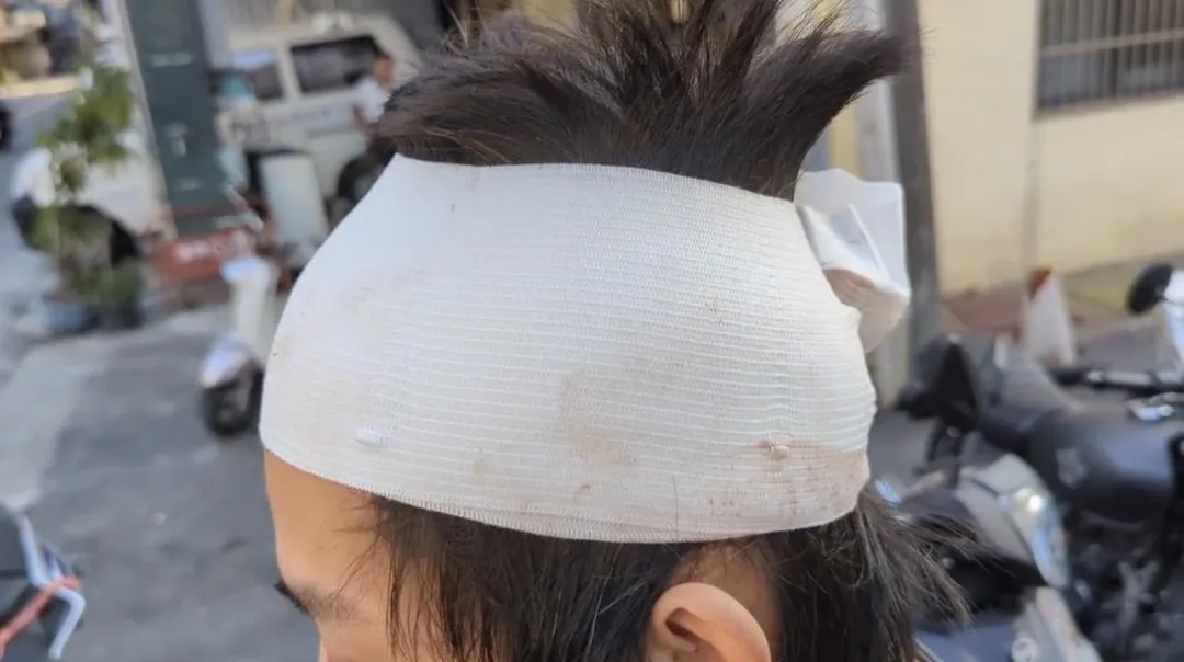 黃男頭部被攻擊受傷。（圖／翻攝畫面）