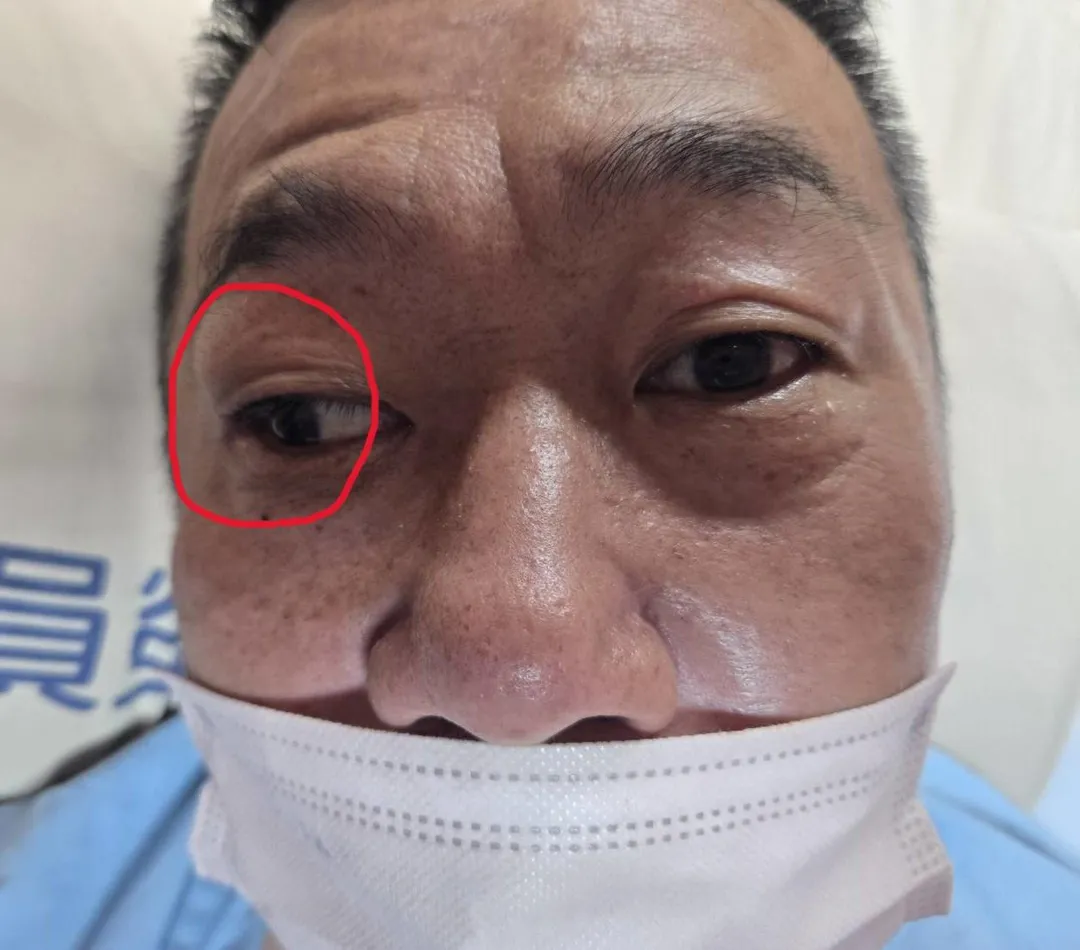 員榮醫院神經內科陳彥秀醫師,診斷黃姓男子右眼無法轉動,是因腦部中風引發。(圖/員榮醫院)
