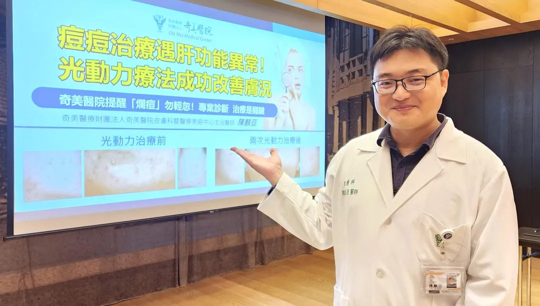 奇美醫療財團法人奇美醫院皮膚科暨醫學美容中心主治醫師陳麒亘。（圖／奇美醫院）