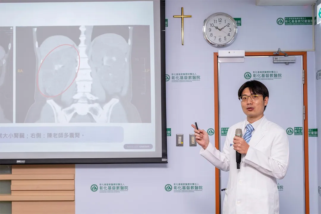 腎臟內科蔡俊傑醫師指出,多囊腎具遺傳傾向,須長期追蹤腎功能與血壓。彰基整合團隊照護與個案管理,提升移植成功與腎存活率。(圖/彰化基督教醫院)