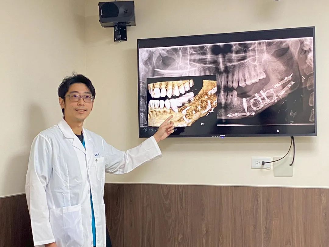 林楠瑾醫師說明植牙設計是利用傾斜式植體All on 的概念完成。（圖／彰化秀傳紀念醫院）