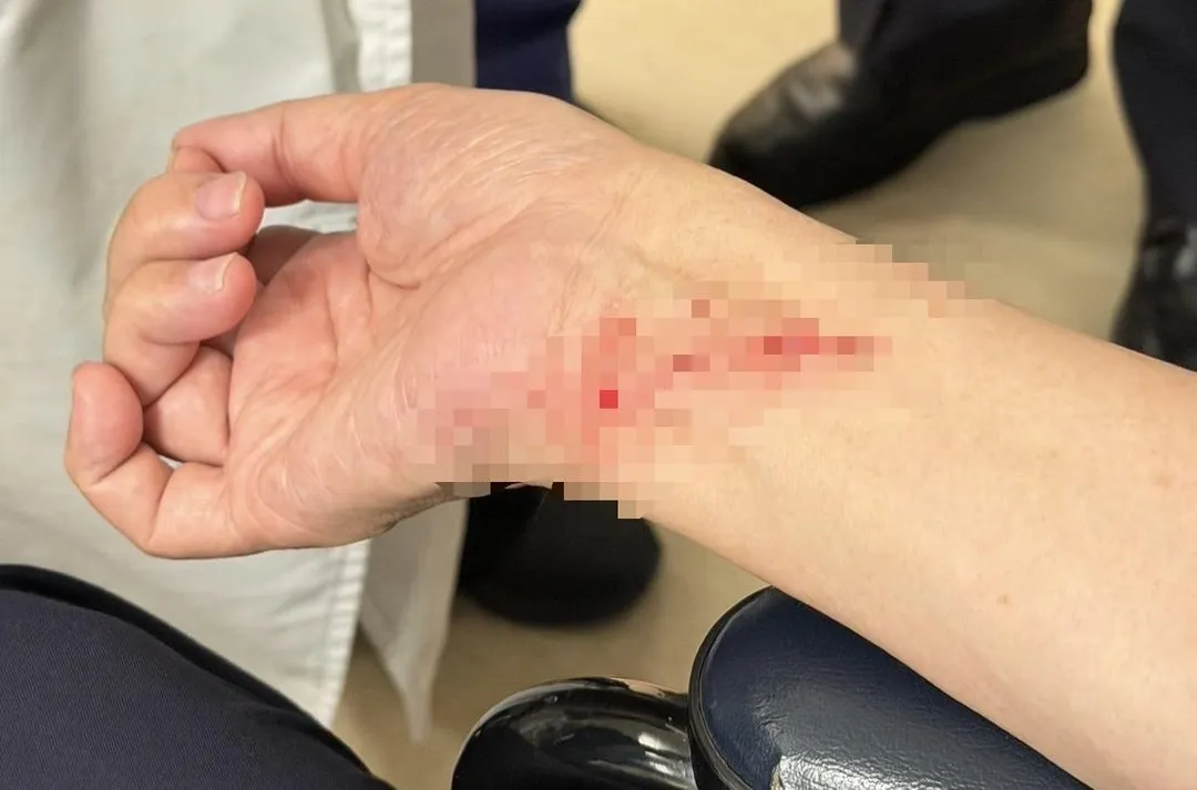 江漢聲右手腕遭砍傷。(圖/翻攝畫面)